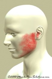 Jaw Muscle Pain