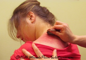 Gua Sha: Breaking up scar tissue