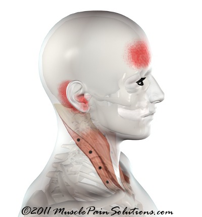Sternocleidomastoid Muscle