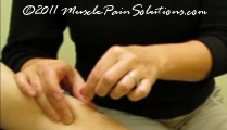 Trigger point dry needling