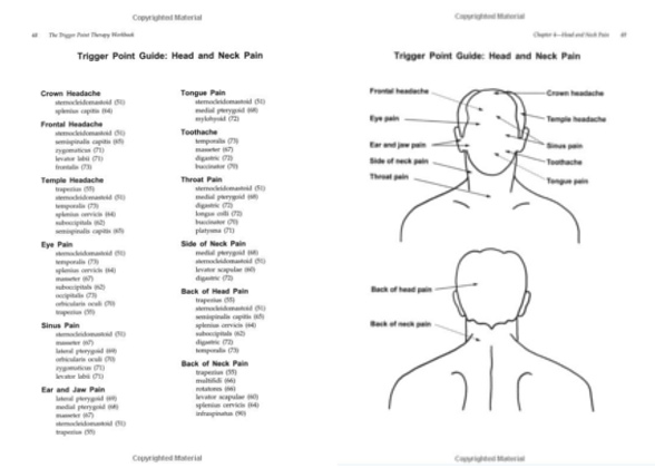 Head And Neck Trigger Point Chart